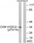 CDK1/CDC2 (Phospho-Thr14) Antibody